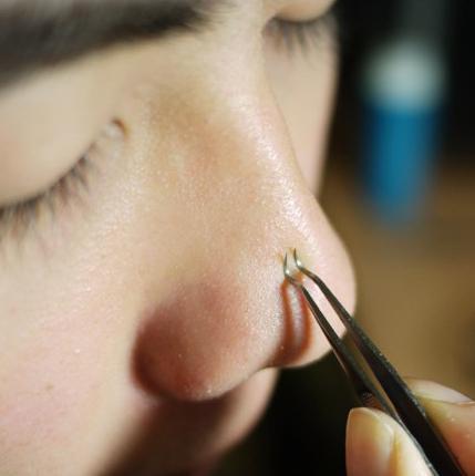 Blackhead and Comedone Acne Extractor - Mounteen. Worldwide shipping available.